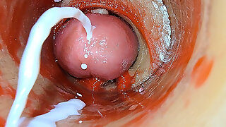 Camera Inside Deep Pussy Captures Overdose Ejaculation of Sperm Asmr